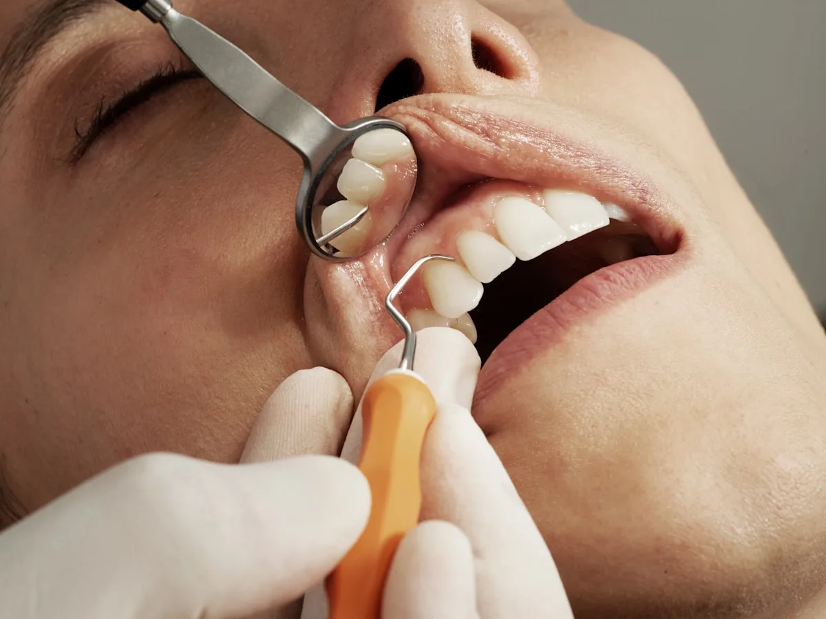 Bác sĩ tư vấn răng sứ thẩm mỹ